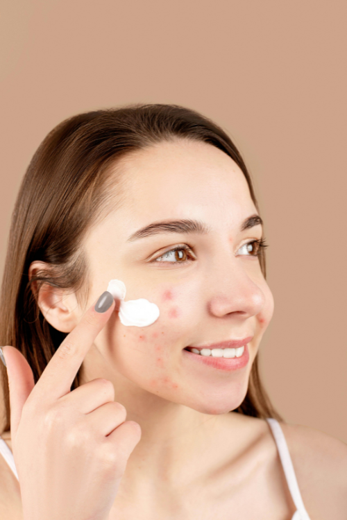 acne treatment acne treatment